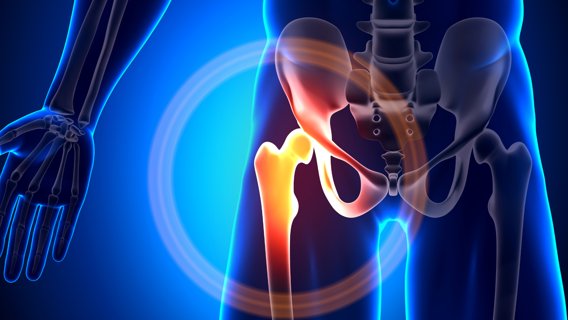 Hip Replacement Surgery Risks and Complications